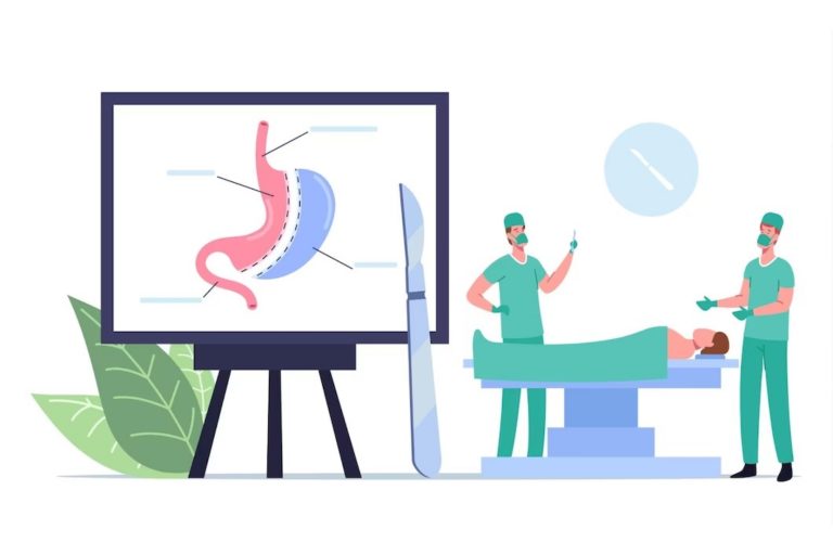 How to Determine if You're a Candidate for Endoscopic Sleeve Gastroplasty (ESG)