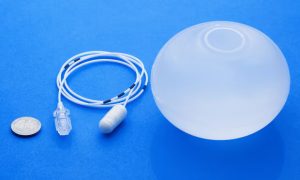 Beyond Weight Loss: The Comprehensive Benefits of Gastric Balloon