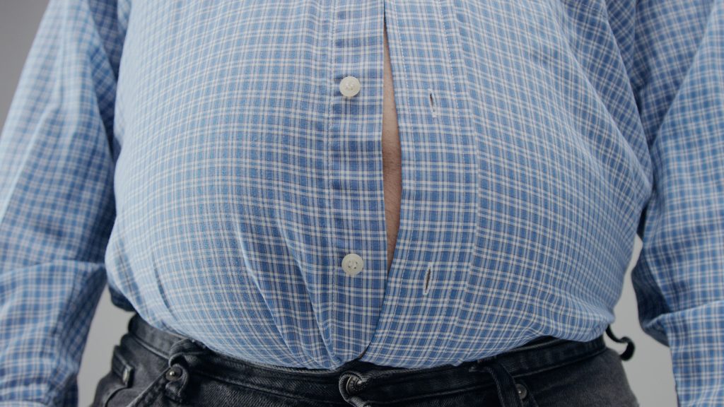 Common Myths and Misconceptions About Obesity Surgery Debunked
